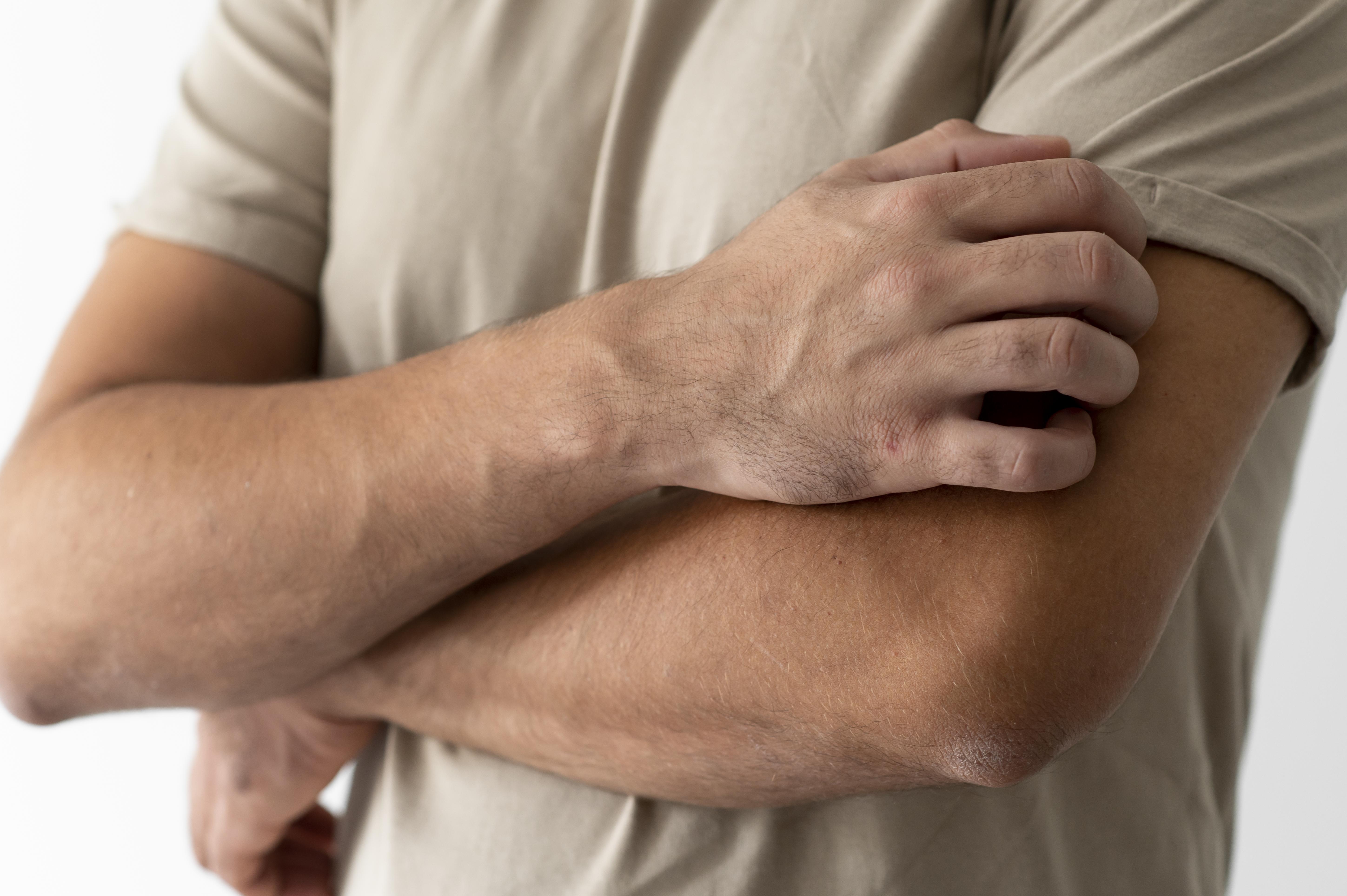 سندروم شوگرن